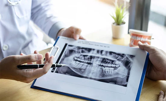 dental x rays