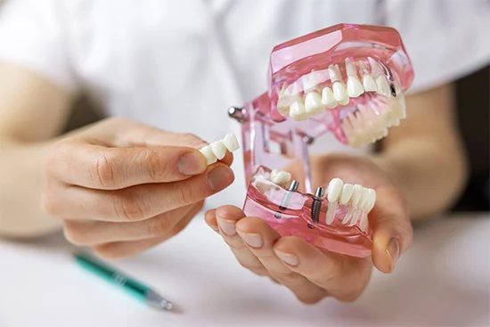 types of dental implants austin