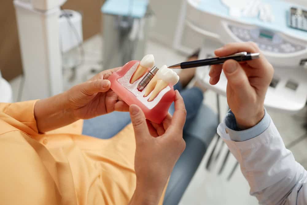 Dental Implants vs. Veneers: Longevity & Care Compared