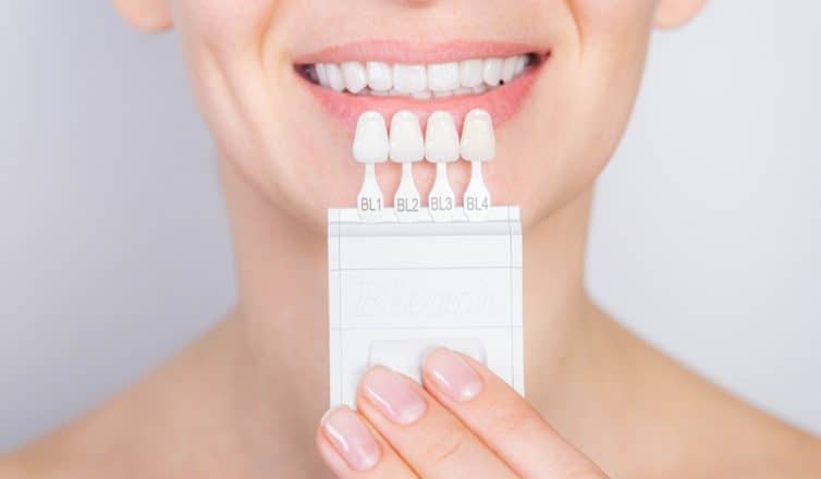 Step-by-Step Guide: Porcelain Veneers Procedure