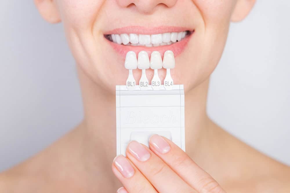 Step-by-Step Guide: Porcelain Veneers Procedure