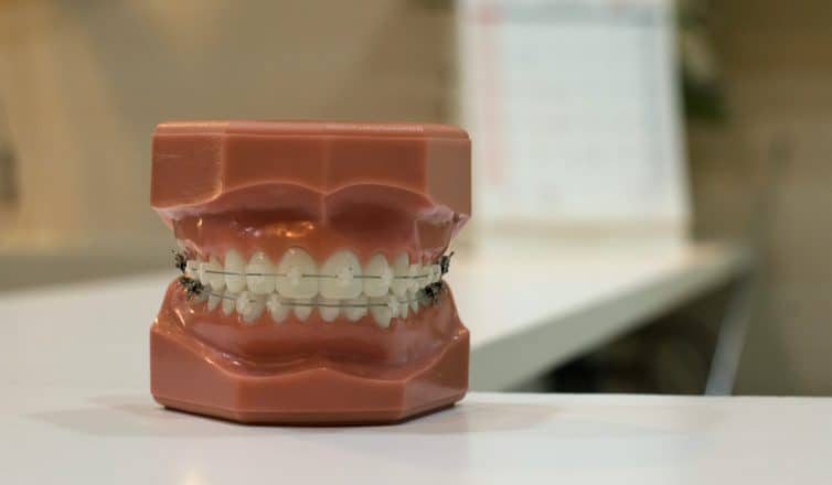 How to Choose Between Braces and Other Teeth Straightening Options in Austin