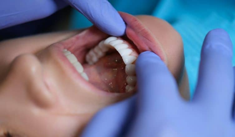 Why Veneers Might Be the Right Choice for Your Smile Improvement