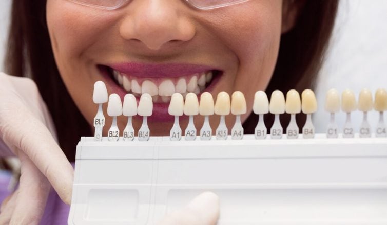 What to Do if Your Veneers Get Damaged