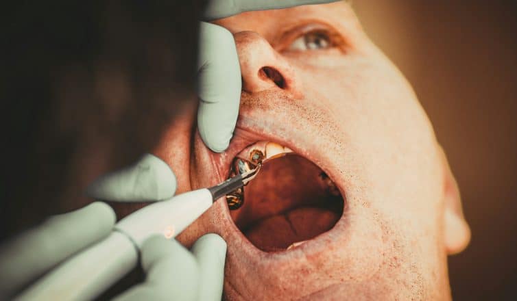 Restorative Dentistry Options for Tooth Restoration