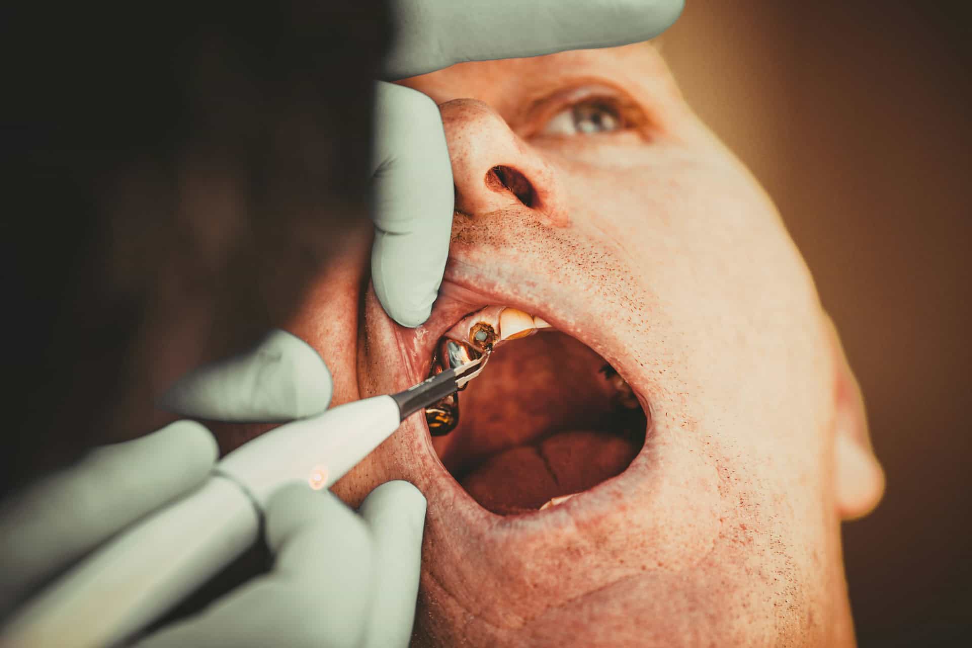 Restorative Dentistry Options for Tooth Restoration