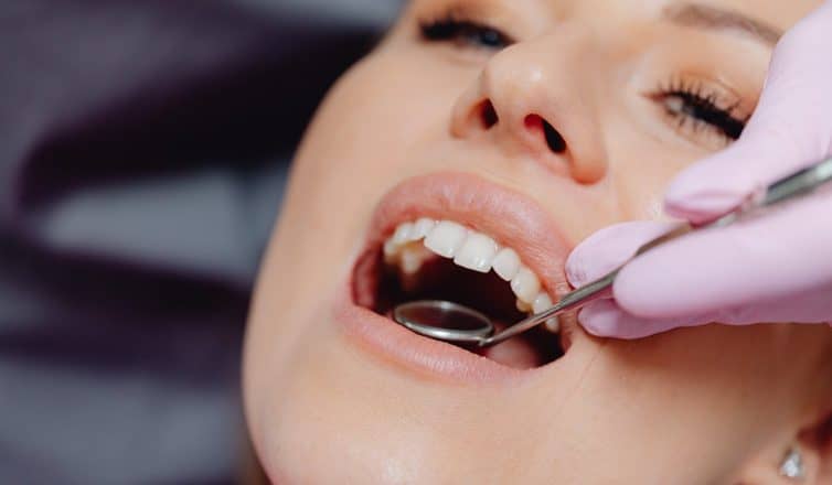 Common Issues with Dental Fillings and How to Address Them