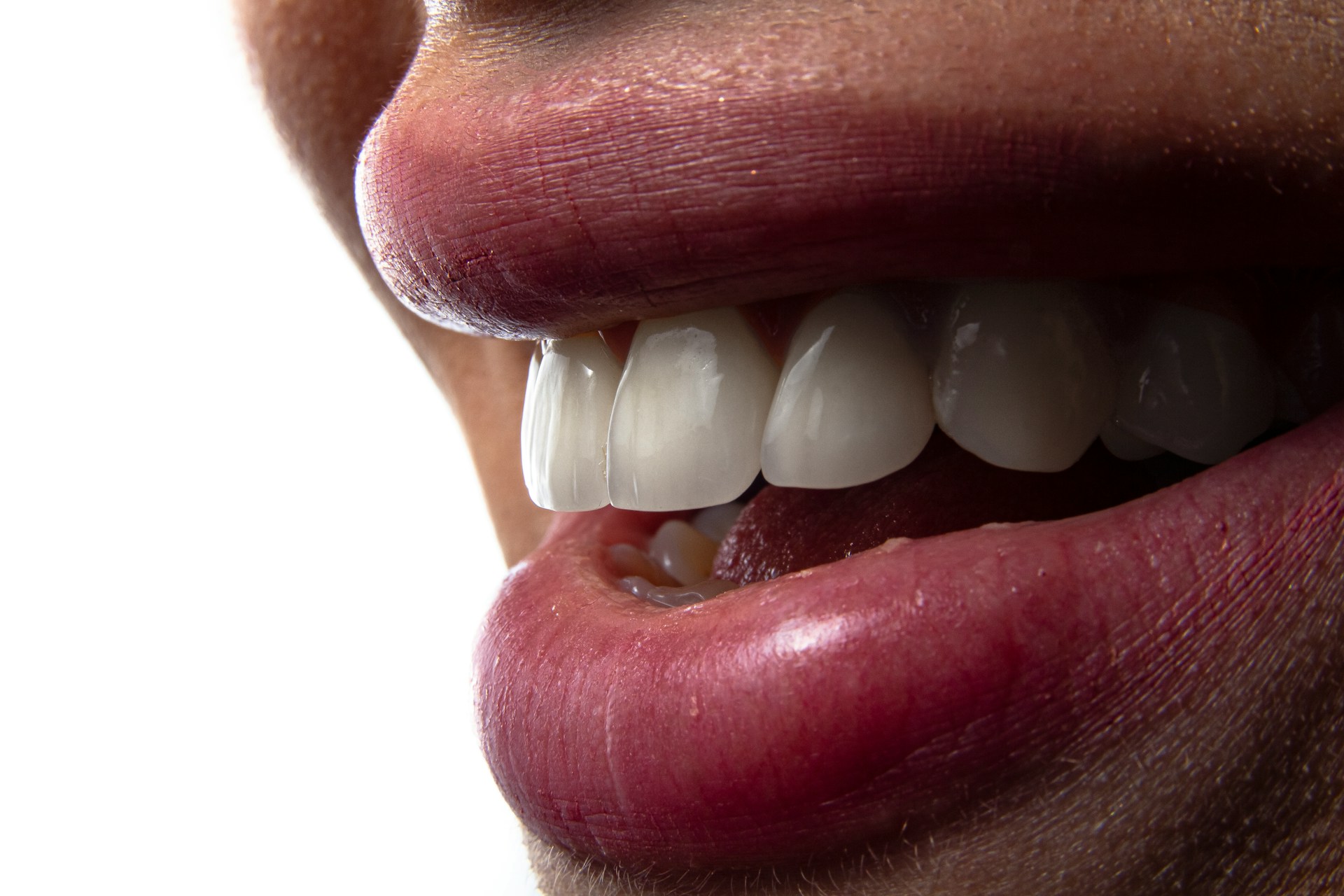 Why Your Tooth-Colored Fillings Might Be Changing Color
